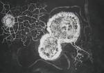 Susan Aldworth. <em>Birth of a Thought</em>, 2007. Etching and aquatint, 35 x 50 cm&nbsp;